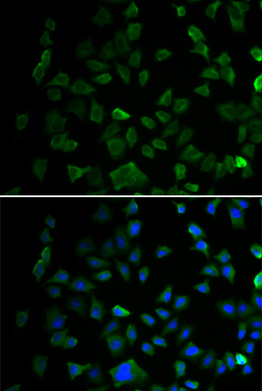 Immunofluorescence analysis of U2OS cells using MEK1 Polyclonal Antibody. Blue: DAPI for nuclear staining.