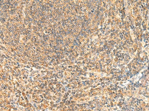 Immunohistochemistry of paraffin-embedded Human tonsil tissue  using ZNF581 Polyclonal Antibody at dilution of 1:50(?200)