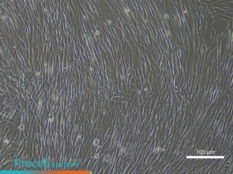 Human Lung Cancer‑Associated Fibroblast Complete Medium - 2