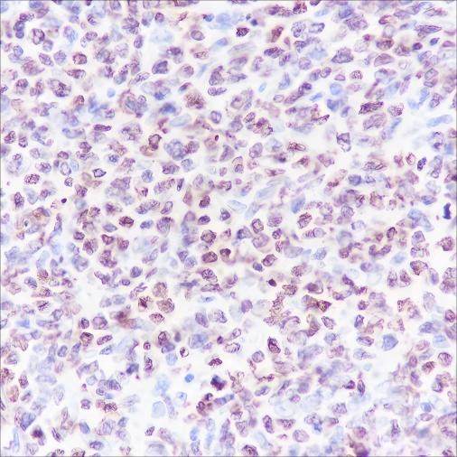 Recombinant CENP-A Monoclonal Antibody - small - 2