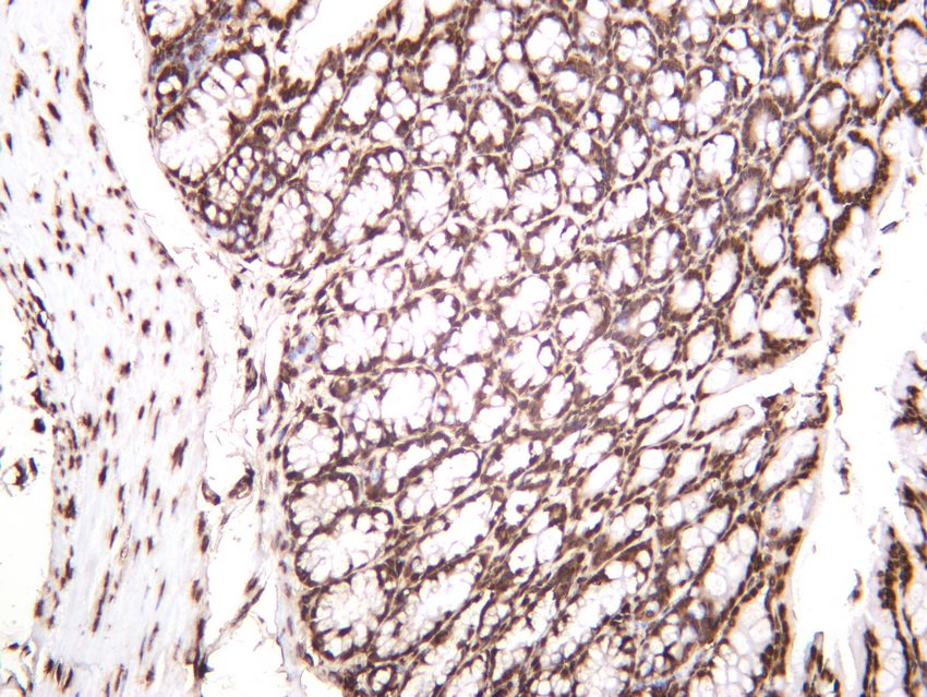 Recombinant Histone H3 Monoclonal Antibody - small - 4