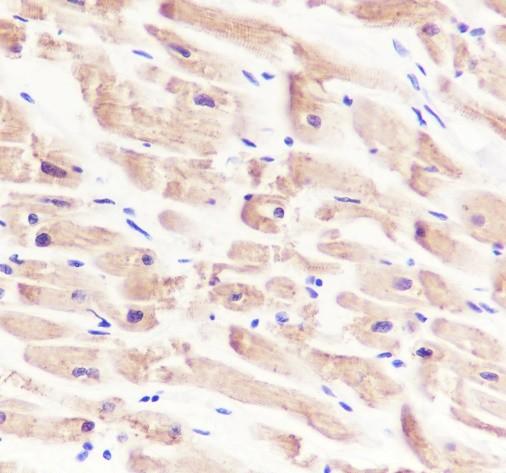 Recombinant alpha Actinin 2 Monoclonal Antibody-searchlist-3