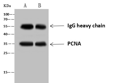 Recombinant PCNA Monoclonal Antibody - small - 2