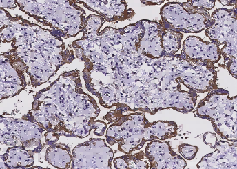 EGFR/HER1/ErbB1 Monoclonal Antibody