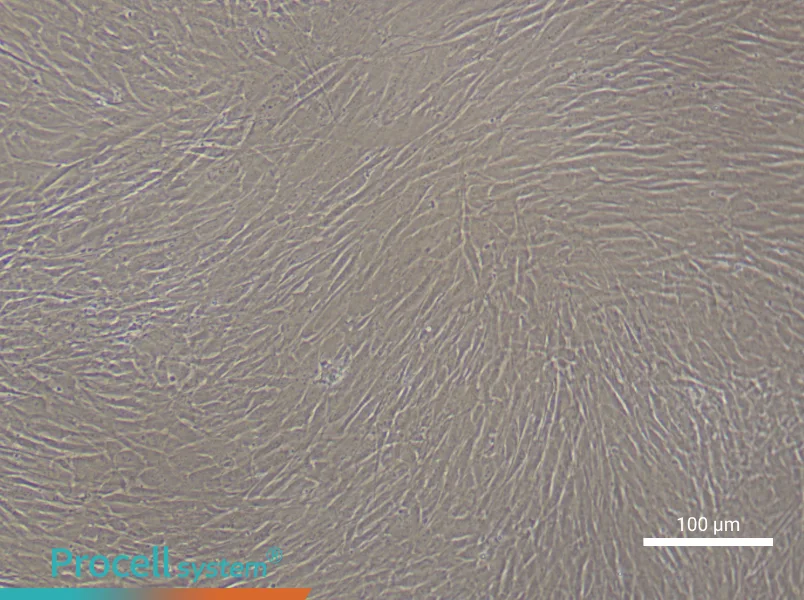 Human Cerebral Artery Smooth Muscle Cell Complete Medium - 2