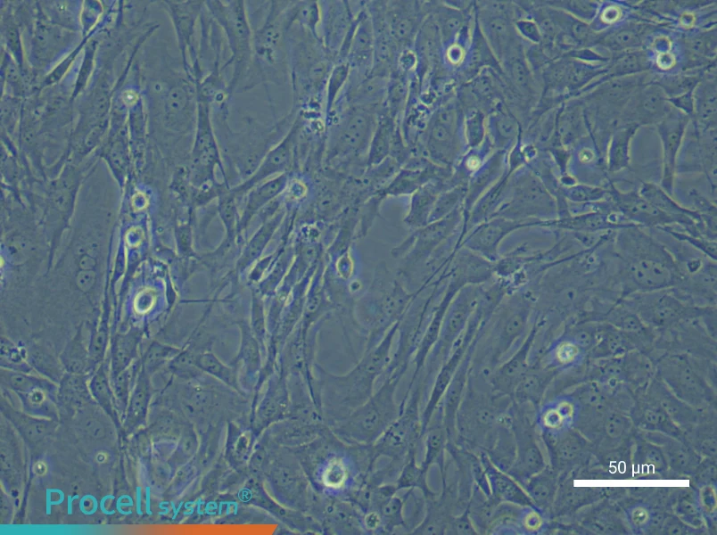 Mouse Periodontal Ligament Fibroblasts - 6