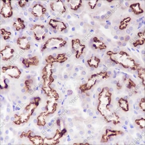 Recombinant Alpha B Crystallin Monoclonal Antibody - 5