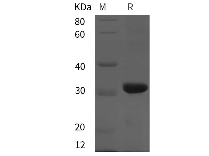 Recombinant Rat CD38/ADPRC1 Protein(His Tag)-1