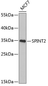 Western blot analysis of extracts of MCF-7 cells using SPINT2 Polyclonal Antibody at 1:1000 dilution.