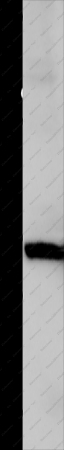 Galectin 1 Polyclonal Antibody - 1