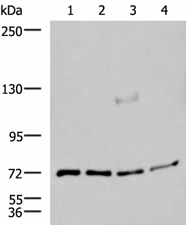 Western blot analysis of A549 A172 TM4 and PC3 cell lysates  using ASTE1 Polyclonal Antibody at dilution of 1:600