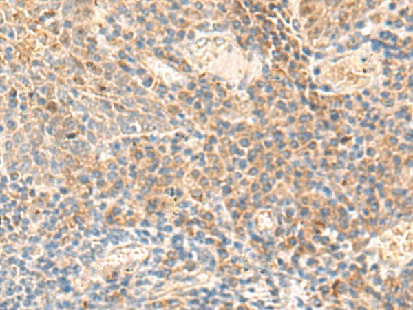 Immunohistochemistry of paraffin-embedded Human tonsil tissue  using ABHD2 Polyclonal Antibody at dilution of 1:50(?200)