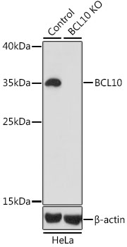 Western blot analysis of extracts from normal (control) and BCL10 knockout (KO) HeLa cells using BCL10 Polyclonal Antibody at dilution of 1:1000.