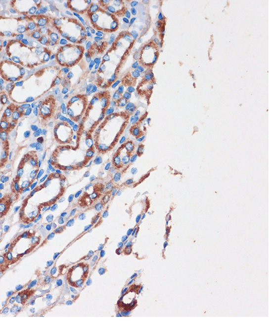 Immunohistochemistry of paraffin-embedded Mouse kidney using CHDH Polyclonal Antibody at dilution of 1:100 (40x lens).Perform microwave antigen retrieval with 10 mM PBS buffer pH 7.2 before commencing with IHC staining protocol.