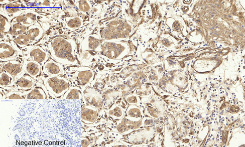 Immunohistochemistry of paraffin-embedded Human stomach tissue using CAV1 Polyclonal Antibody at dilution of 1:200.