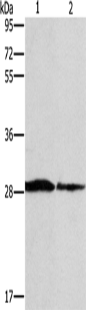 Western Blot analysis of Human chromaffin cell tumor tissue and lovo cell using SPR Polyclonal Antibody at dilution of 1:1500