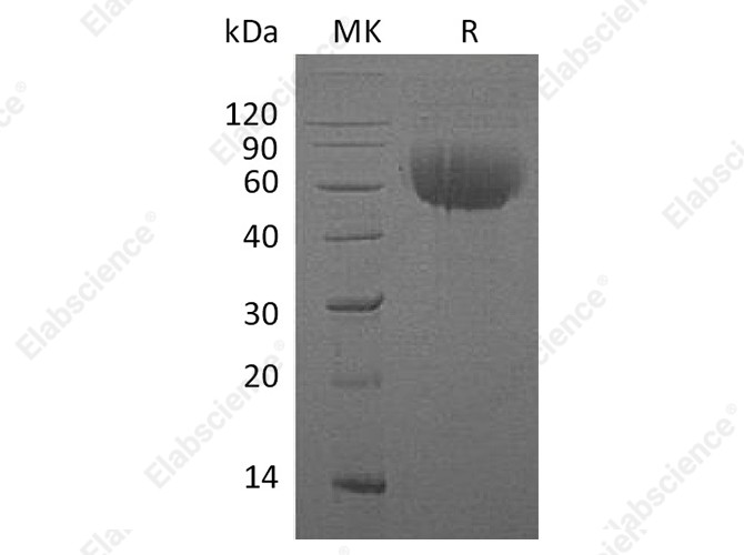 Recombinant Human IL13RA1 Protein (His Tag) - 1