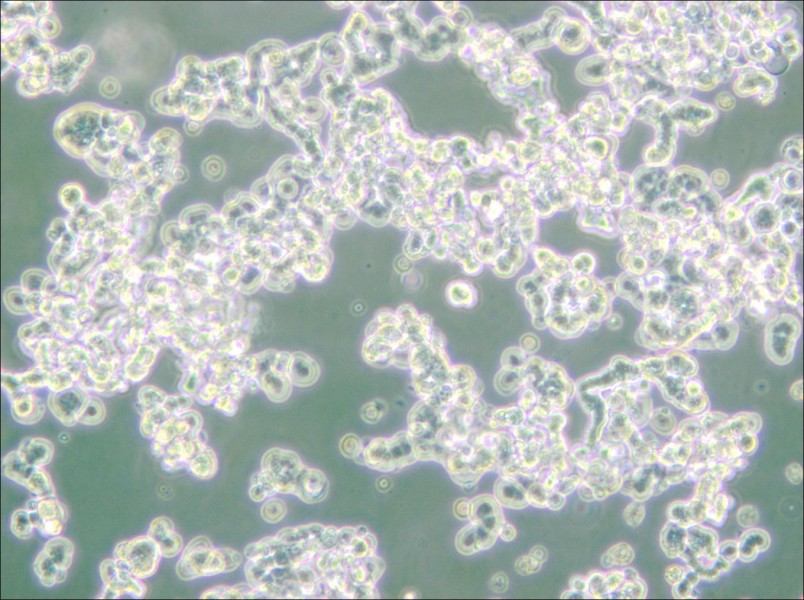 WERI-Rb-1 Cell Complete Medium - small - 5