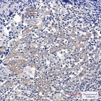 Recombinant Glucose 6 Phosphate Dehydrogenase Monoclonal Antibody - 3