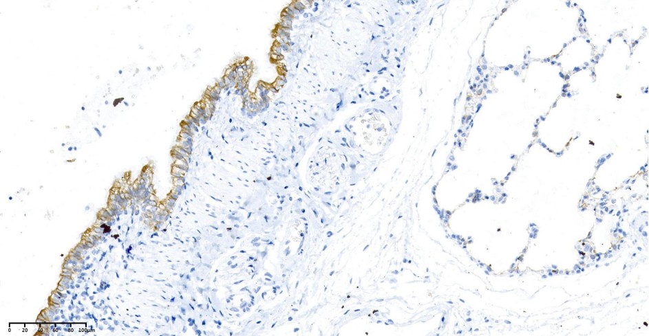 Recombinant Cytokeratin 19 Monoclonal Antibody - small - 2