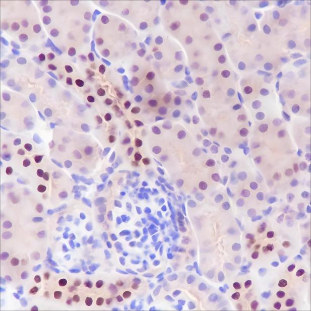 Recombinant BAF60C Monoclonal Antibody - small - 3