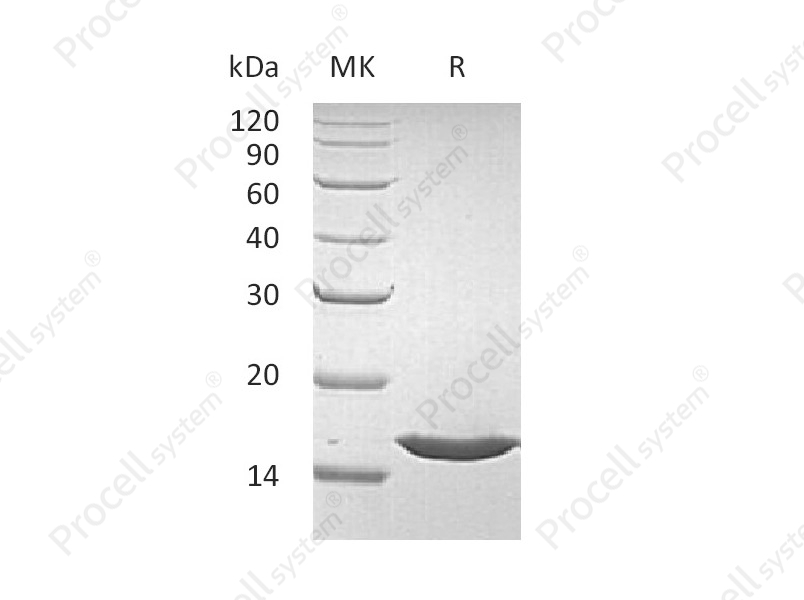 FGF-1/FGFa/FGF-acidic (Phe16-Asp155), Human, Recombinant