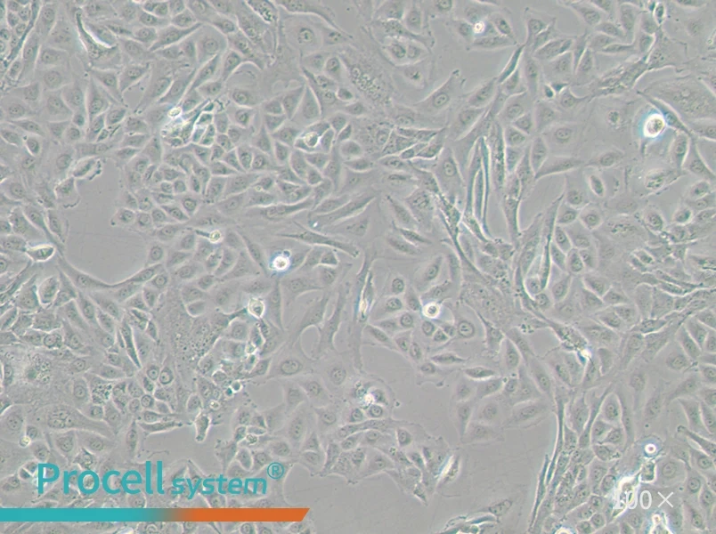 J82 Cell Complete Medium - 2