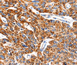 HSP75 Polyclonal Antibody - 3
