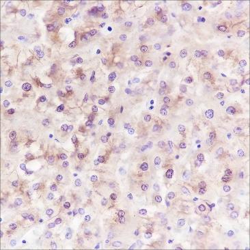 Recombinant FASN Monoclonal Antibody - 2
