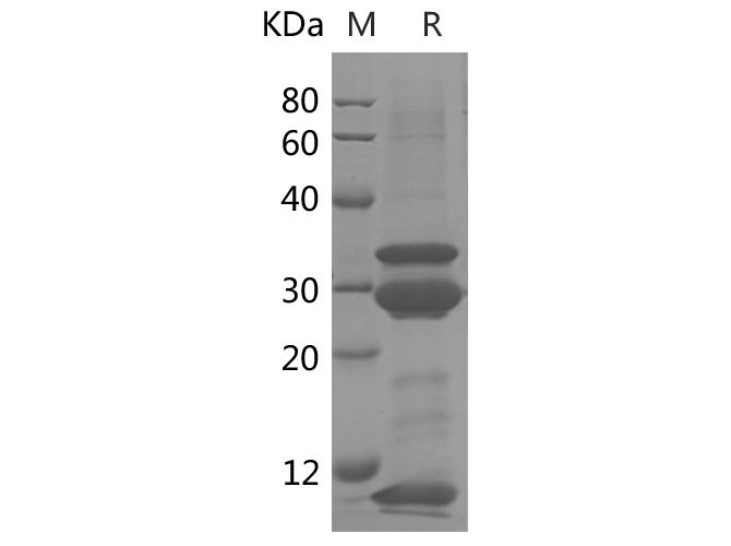 Recombinant Mouse IL-17A Protein(Sumo Tag)-产品推荐-1