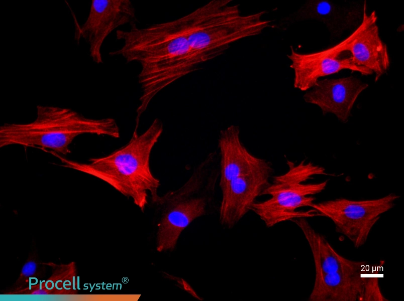 Rat Great Saphenous Vein Smooth Muscle CellsRat Great Saphenous Vein Smooth Muscle Cells - 2