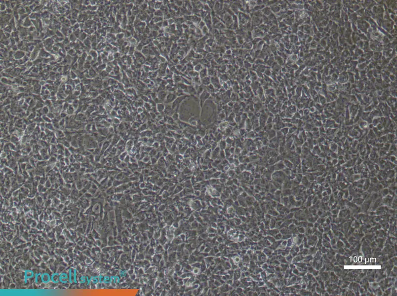 Mouse Pulmonary Microvascular Endothelial (Primary cell immortalization) Cell Complete MediumMouse Pulmonary Microvascular Endothelial (Primary cell immortalization) Cell Complete Medium - 3