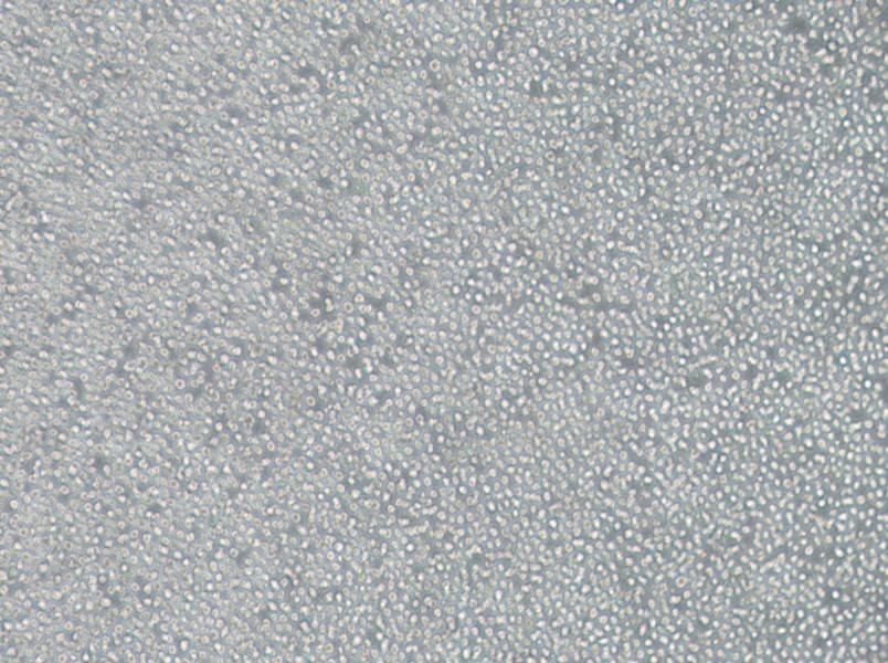 OCI-AML-3 Cell Complete Medium - 3