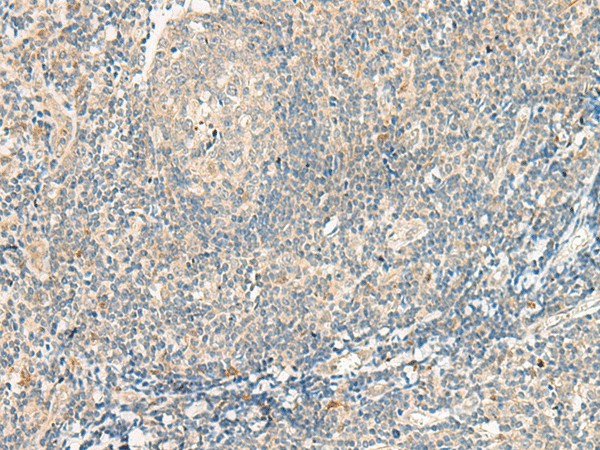 Immunohistochemistry of paraffin-embedded Human tonsil tissue  using GPR75 Polyclonal Antibody at dilution of 1:95(?200)