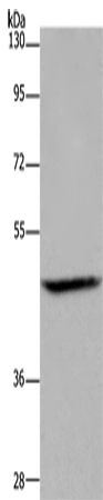 Western Blot analysis of Mouse brain tissue using ETS2 Polyclonal Antibody at dilution of 1:500