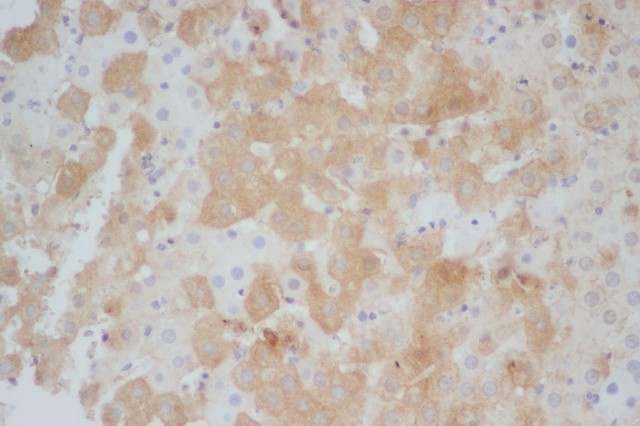 Immunohistochemistry of paraffin-embedded Rat liver using STAT1 Polyclonal Antibody at dilution of 1:50