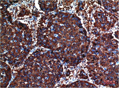AKT1 Monoclonal Antibody
