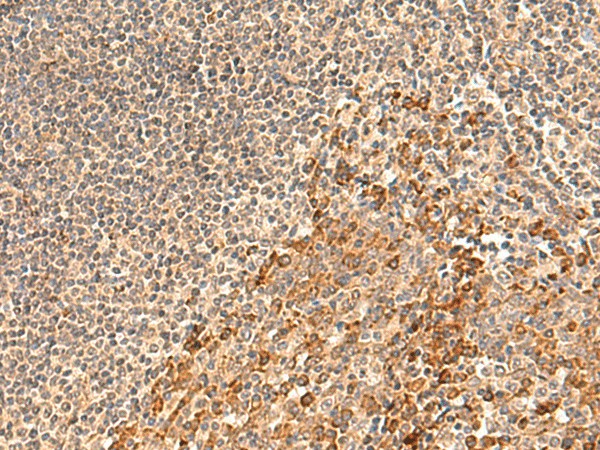 Immunohistochemistry of paraffin-embedded Human tonsil tissue  using GALNT12 Polyclonal Antibody at dilution of 1:60(?200)