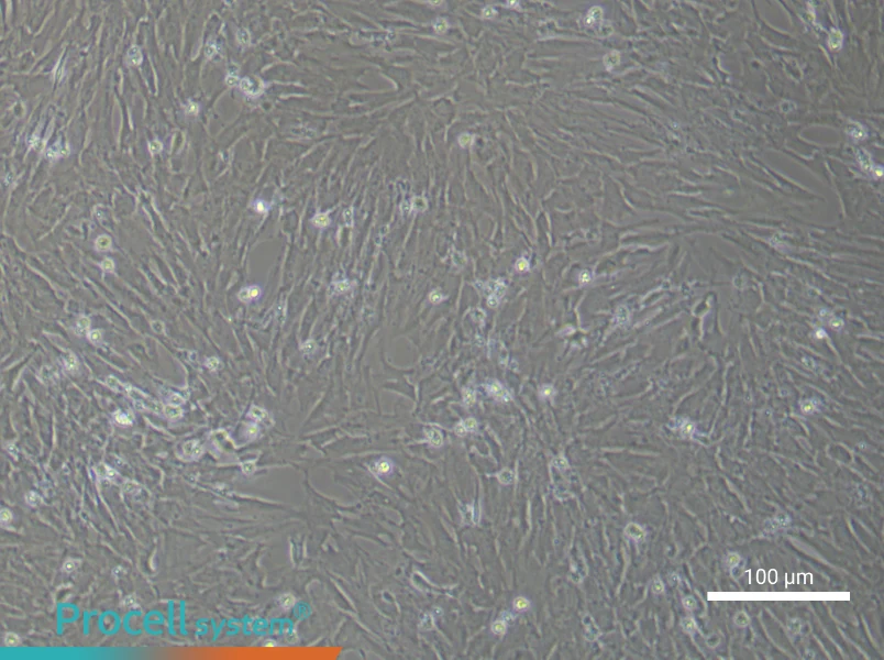 Rat Bladder Fibroblast Complete Medium - 3