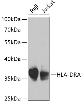 Western blot analysis of extracts of various cell lines using HLA-DRA Polyclonal Antibody at 1:1000 dilution.