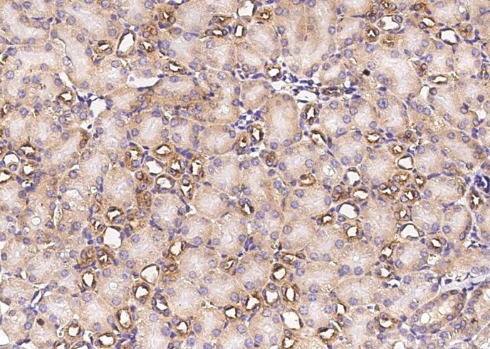 Recombinant MAP2 Monoclonal Antibody - small - 2