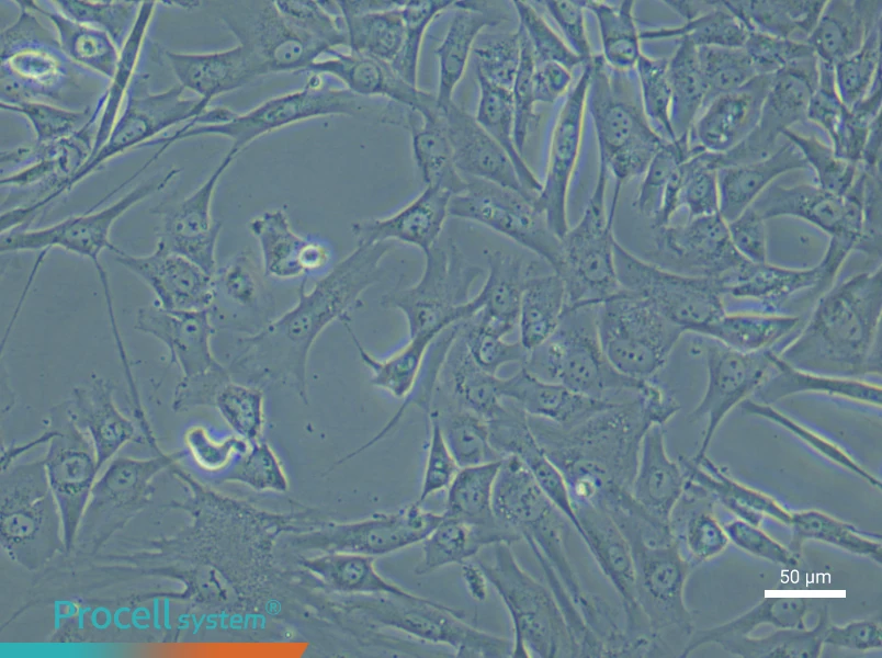 Human Dermal Papilla (Primary cell immortalization) Cell Complete Medium - 4