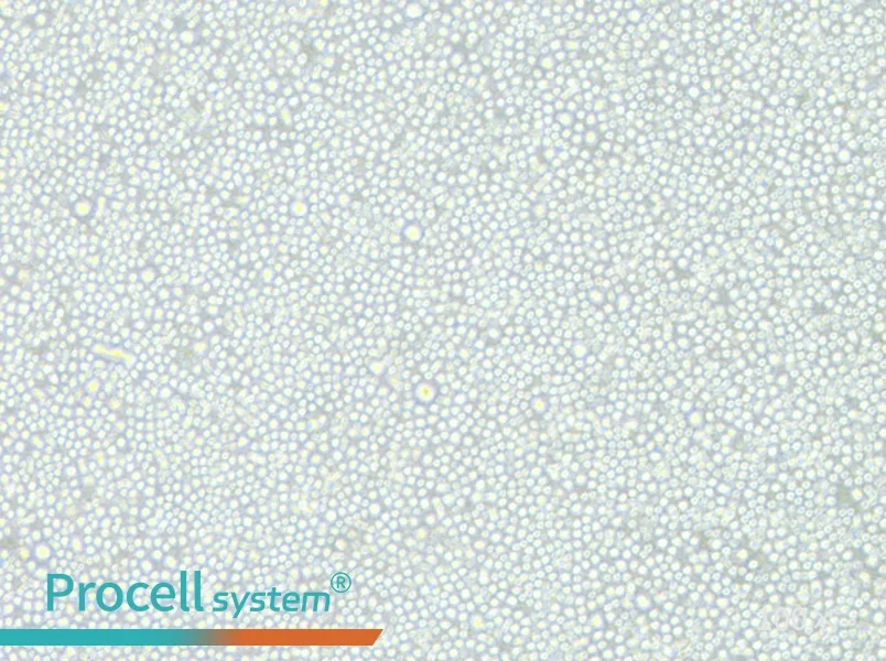 CEM/C1 Cell Complete Medium - 1