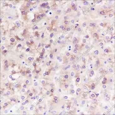 Recombinant FASN Monoclonal Antibody - 2