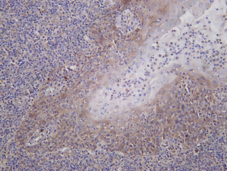 Recombinant TLR3 Monoclonal Antibody - 1