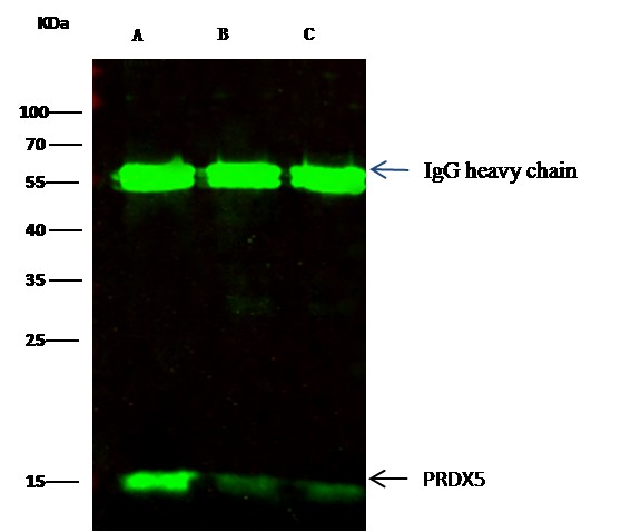 Recombinant Peroxiredoxin 5/PRDX5 Monoclonal Antibody-searchlist-1
