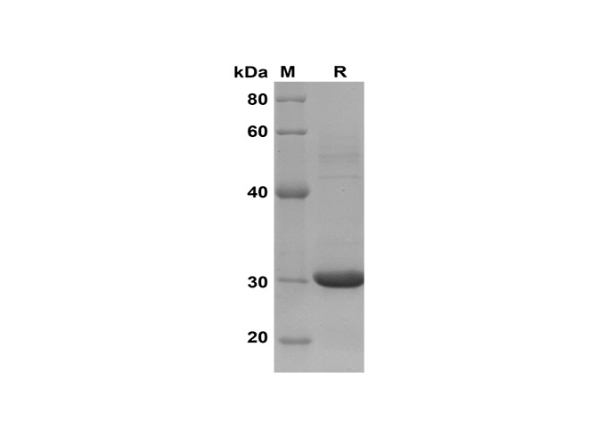 Recombinant Rat CD75/ST6GAL1 Protein (His Tag)-产品推荐-1