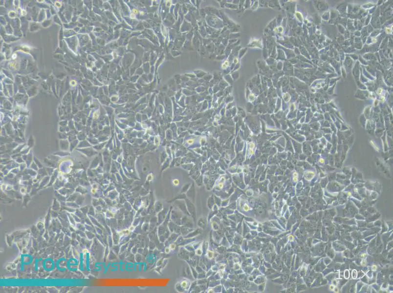 NCI-H358 Cell Complete Medium - 1