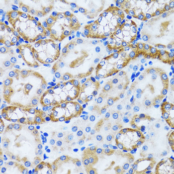 Immunohistochemistry of paraffin-embedded Mouse kidney using PEX5 Polyclonal Antibody at dilution of 1:100 (40x lens).