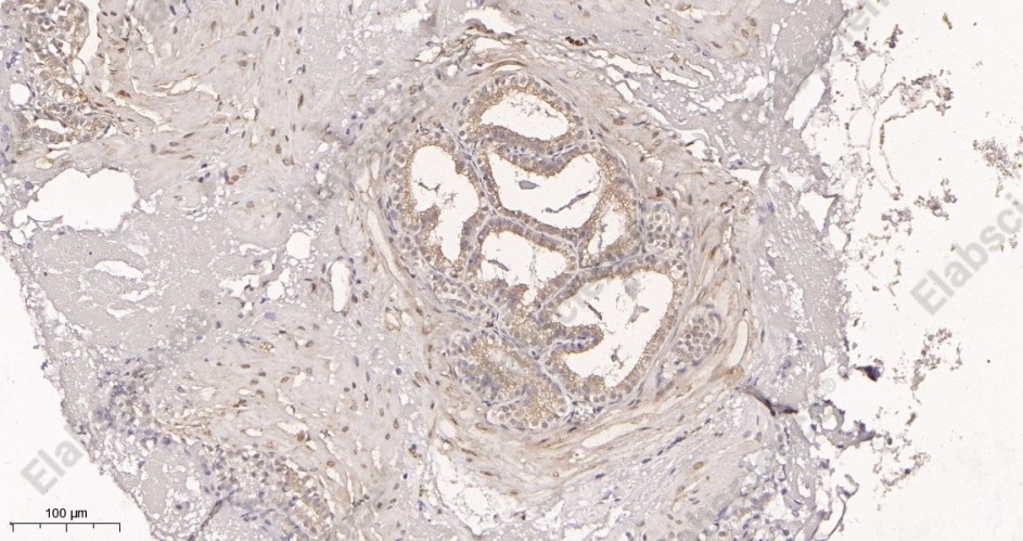 Recombinant LC3A Monoclonal Antibody - 3